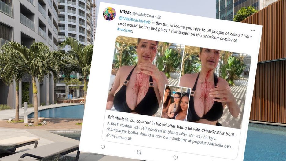 Kłótnia o leżaki w Hiszpanii (zdjęcie ilustracyjne) 