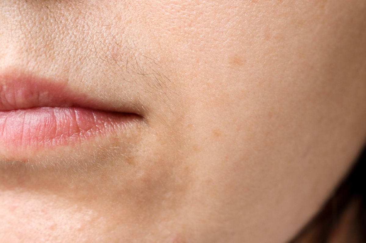 Homemade solutions for managing a woman's moustache naturally