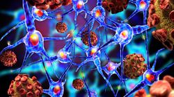 Klebsiella pneumoniae - charakterystyka, drogi zarażenia, objawy, leczenie