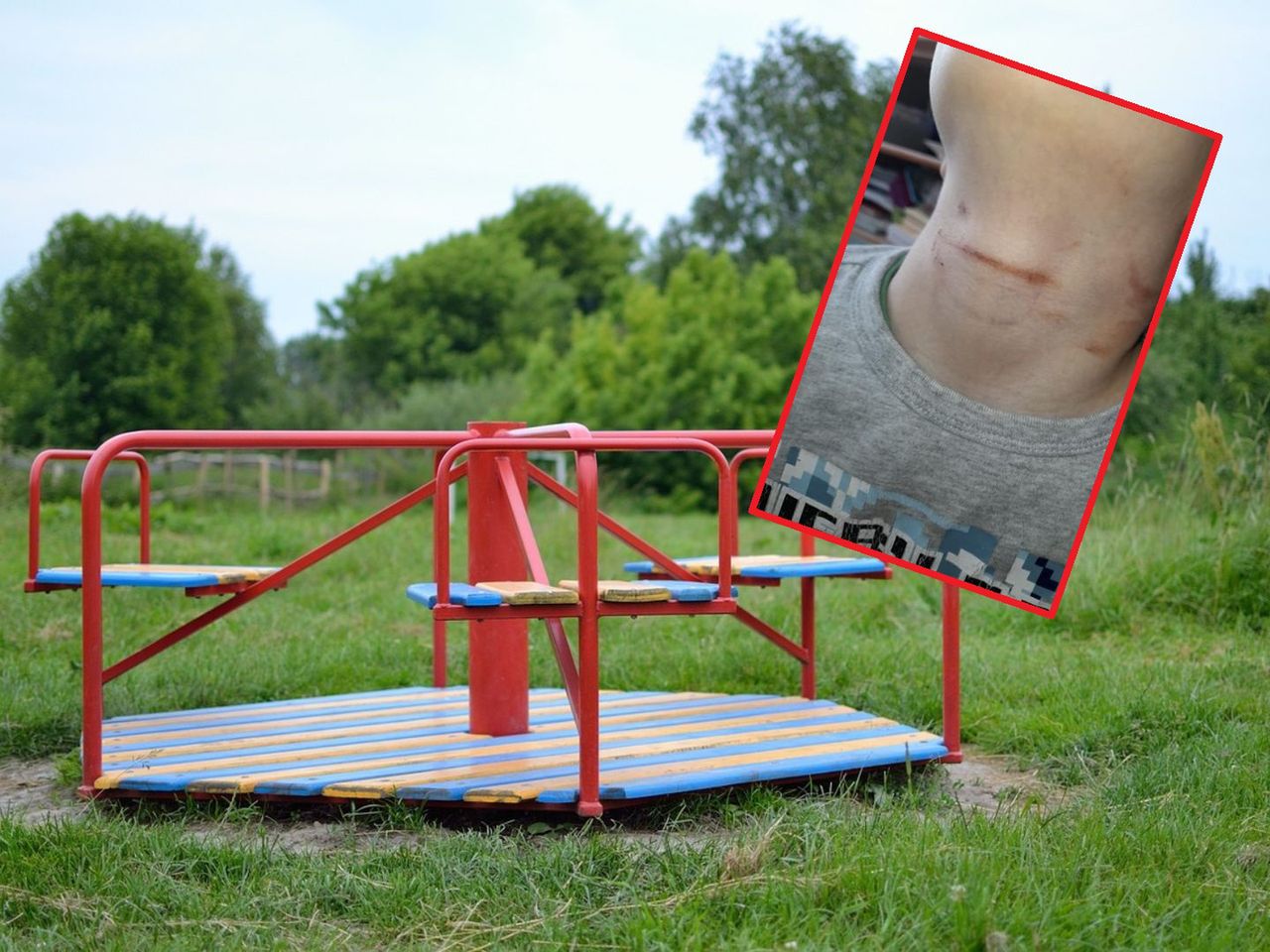 Skandal w przedszkolu. Twierdzi, że ją zwolniono, bo zgłosiła bicie dzieci