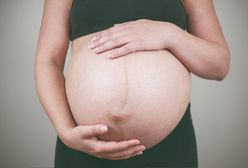 Fotografka pokazała zdjęcie kobiety po porodzie. Matki zareagowały