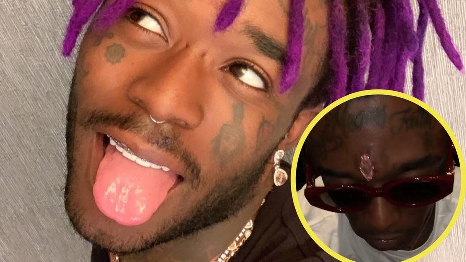 Lil Uzi Vert wszczepił sobie diament w czoło.