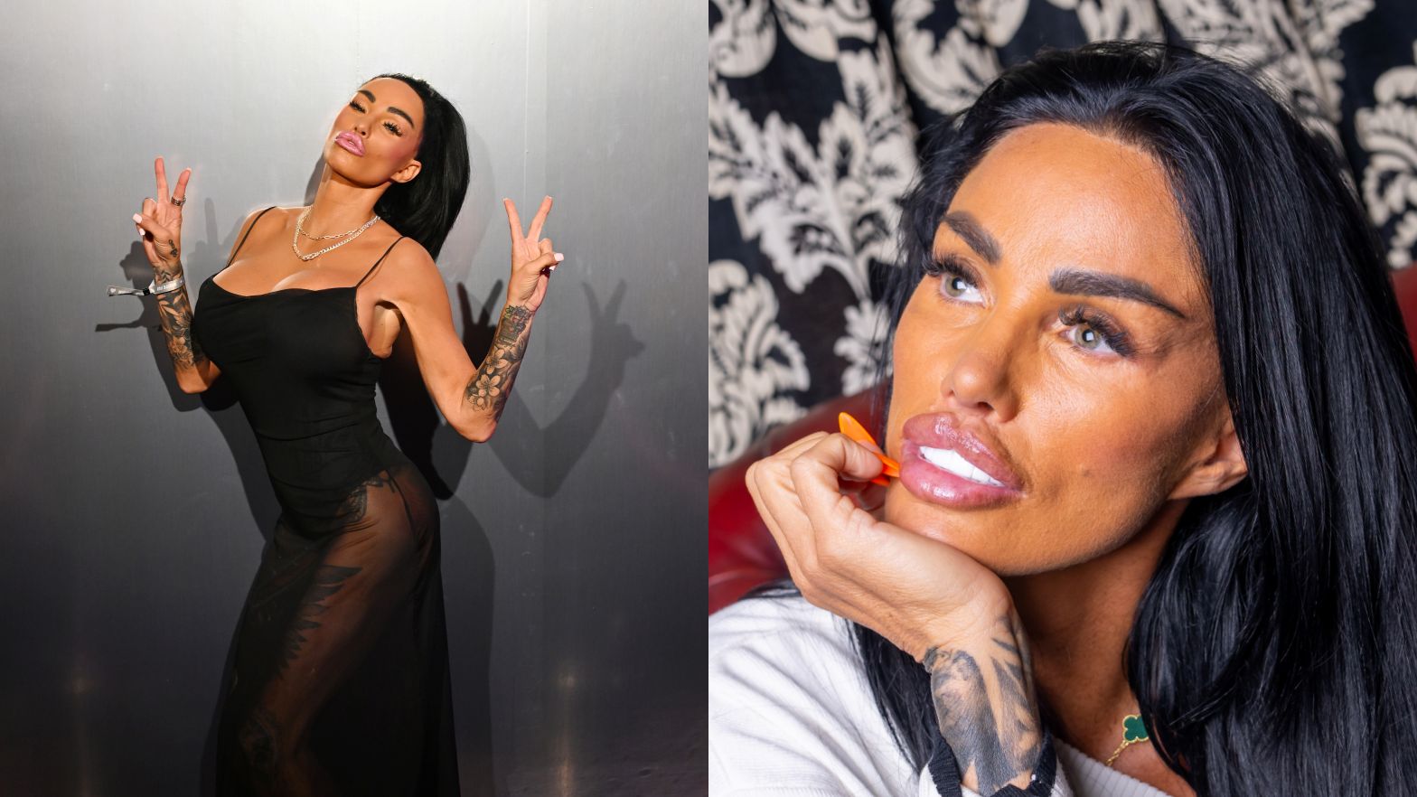Katie Price przeszła dziesiątki operacji plastycznych