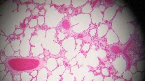 Rak wykryty w kilka minut 1