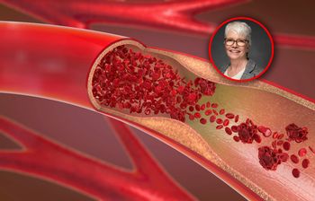 Cichy sygnał ostrzegawczy. Znak, że cholesterol jest za wysoki