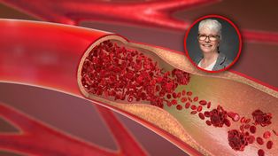 Cichy sygnał ostrzegawczy. Znak, że cholesterol jest za wysoki