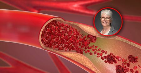 Cichy sygnał ostrzegawczy. Znak, że cholesterol jest za wysoki