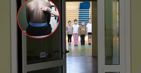Fala zwolnień z lekcji WF-u wśród dzieci i nastolatków. Są dane z MEN