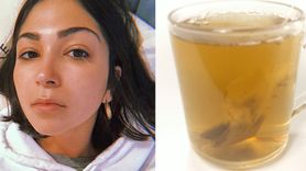 Herbaty promowane przez Kim Kardashian zniszczyły żołądek młodej kobiety