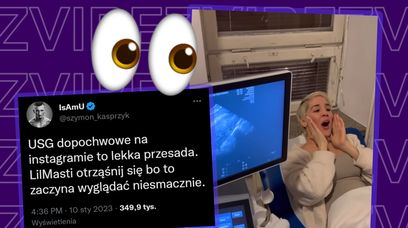 Ciężarna Lil Masti relacjonuje badanie USG u Mamy Ginekolog