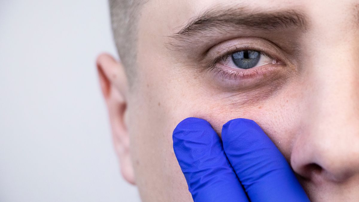 Objawy chorób na twarzy