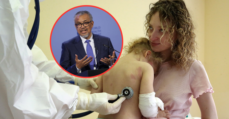Ponad 14 mln dzieci bez szczepień. Niepokojące prognozy WHO