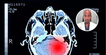 Typowy objaw guza mózgu. Neurochirurg: Nigdy nie powinien być ignorowany