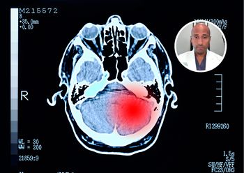 Typowy objaw guza mózgu. Neurochirurg: Nigdy nie powinien być ignorowany