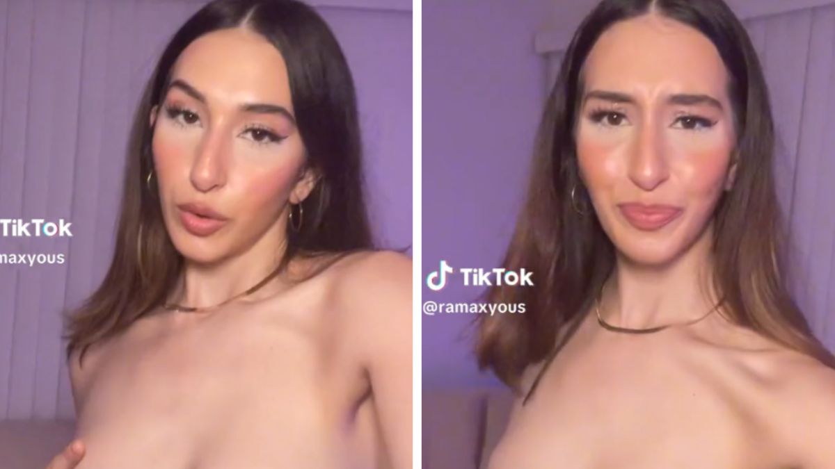 Dzięki operacji biust modelki zmniejszył się z miseczki G na D