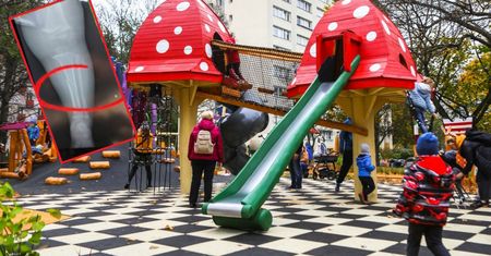 Lekarka ostrzega przed popularną zabawą na zjeżdżalni. Pokazała zdjęcie