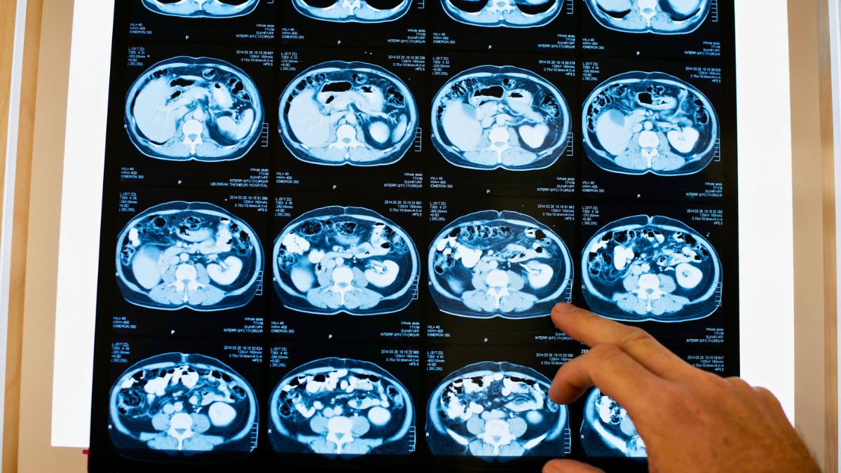 Lekarz ogląda zdjęcia mózgu