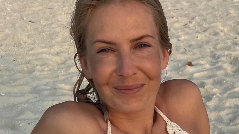 Edyta Pazura zdradza, co sądzi o medycynie estetycznej