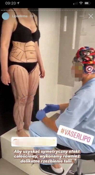 Instastories z profilu kliniki reklamowanej przez Justynę Gradek