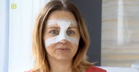 Kasia Klich pokazała nowy nos. Efekt warty był cierpienia?