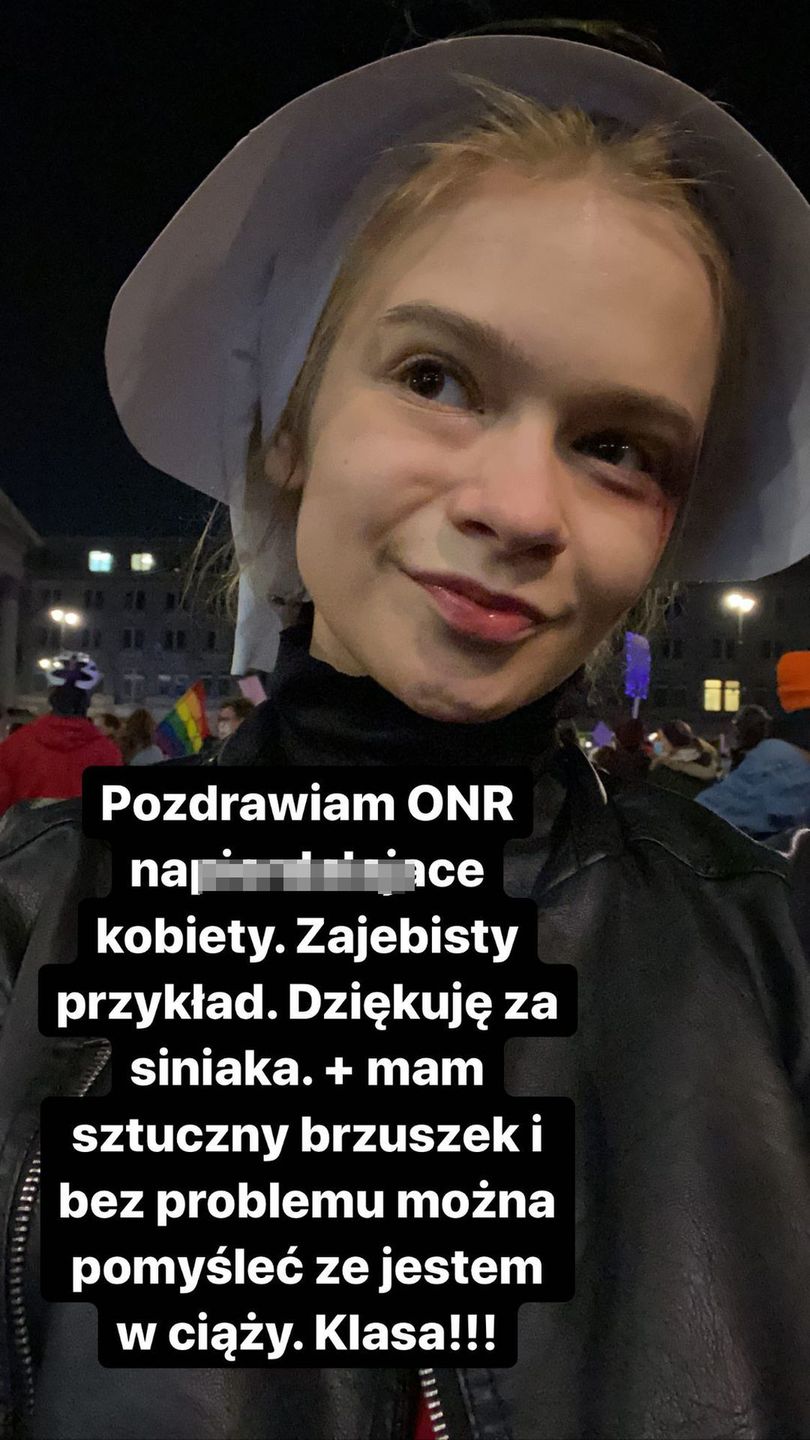 Julia Wróblewska została pobita na Strajku Kobiet w Warszawie