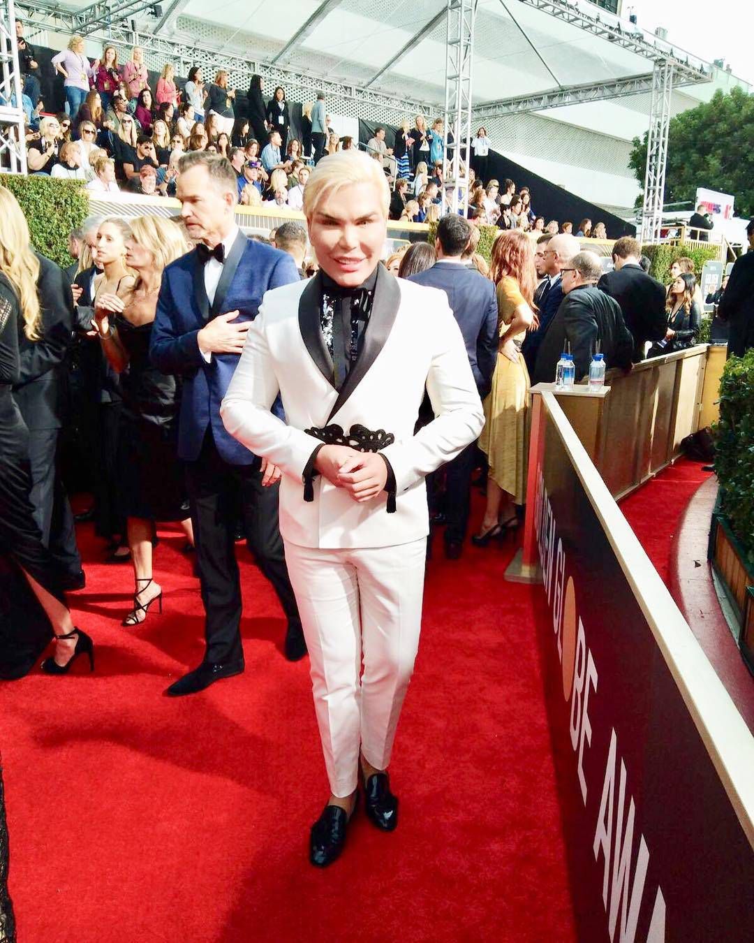 Rodrigo Alves - żywy Ken wyciął sobie cztery żebra