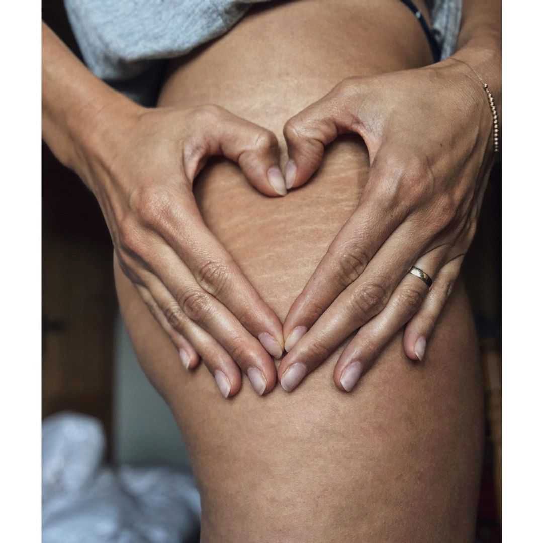 Aleksandra Żebrowska pokazała rozstępy - Instagram