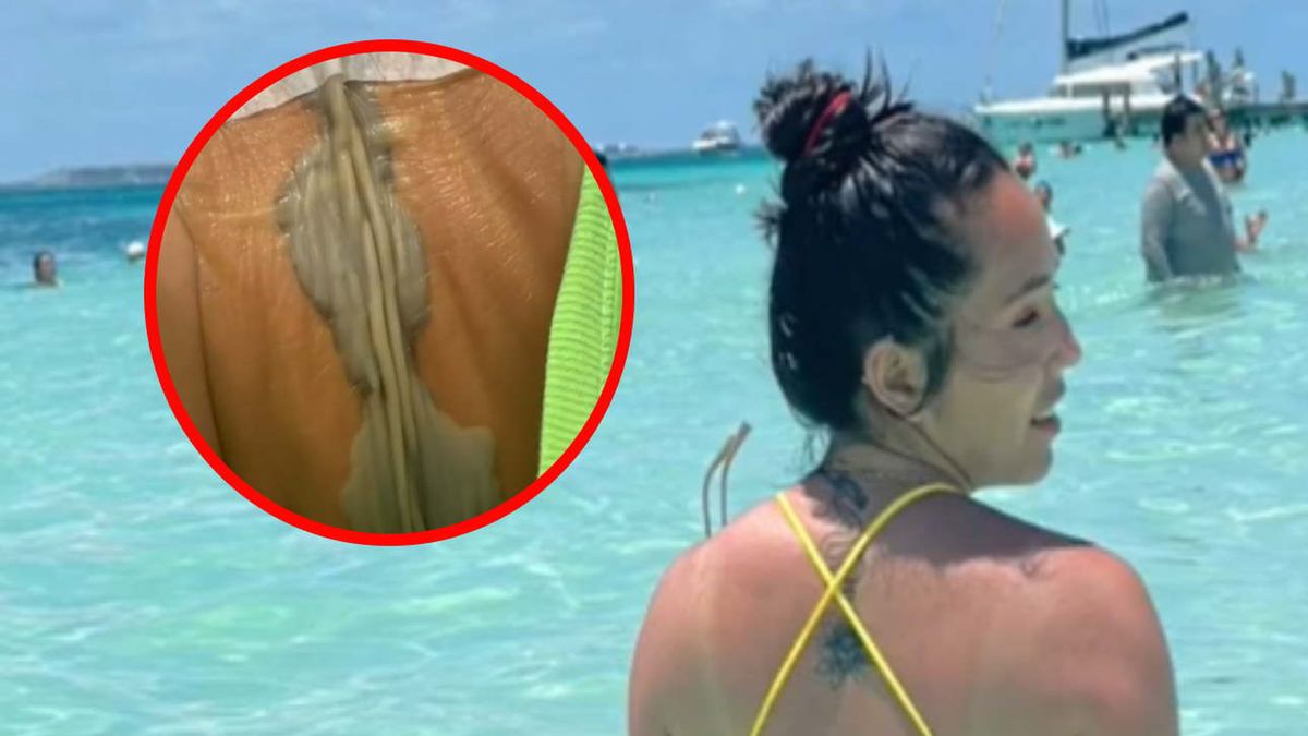 Internauci są zaniepokojeni stanem tatuażu młodej kobiety