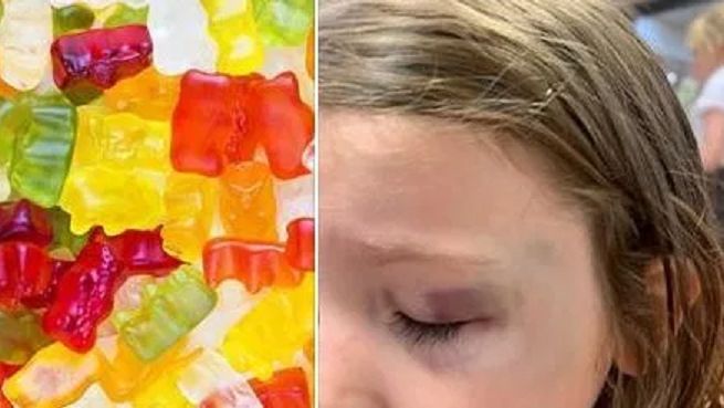 Żelki na urazy głowy