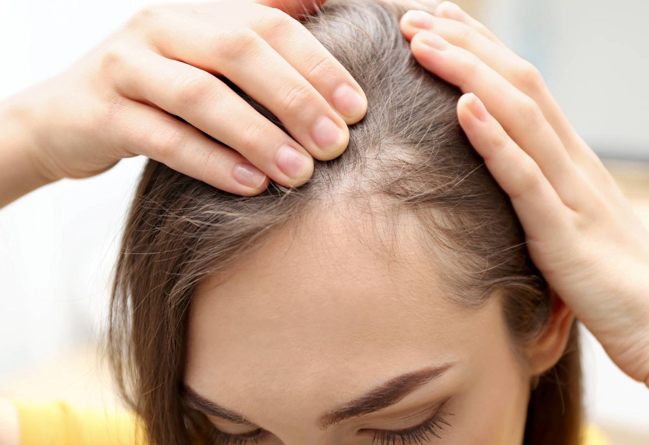 A brilliant solution for a receding hairline. Your hair will instantly "shoot out"