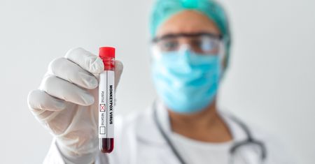 Polski rząd reaguje na małpią ospę. Trwają rozmowy ws. zakupu leku
