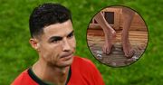 Stopy Cristiano Ronaldo wyglądają niepokojąco? Podolożki się im przyjrzały