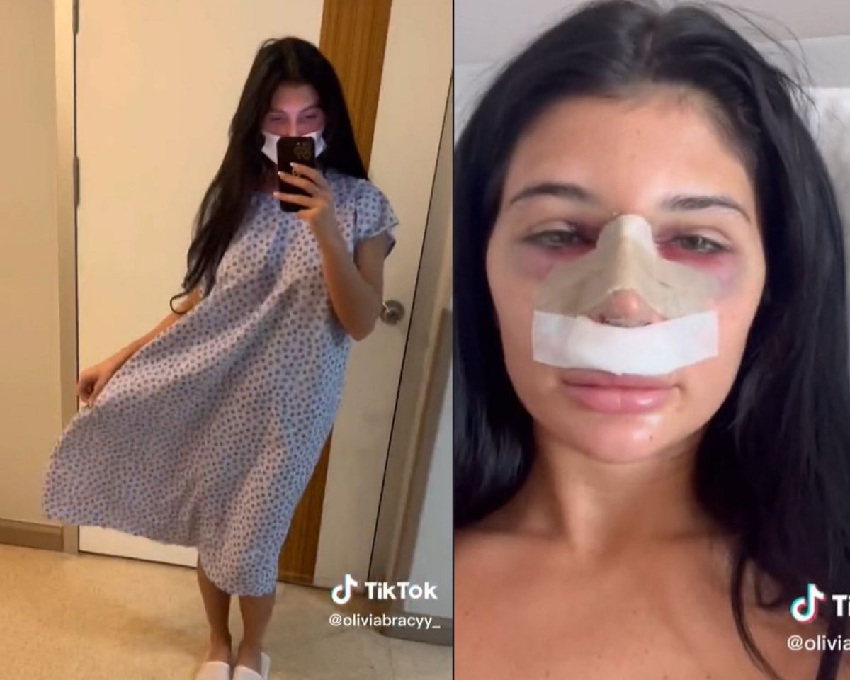 Zrobiła operację nosa w Turcji. To robili ludzie w samolocie
