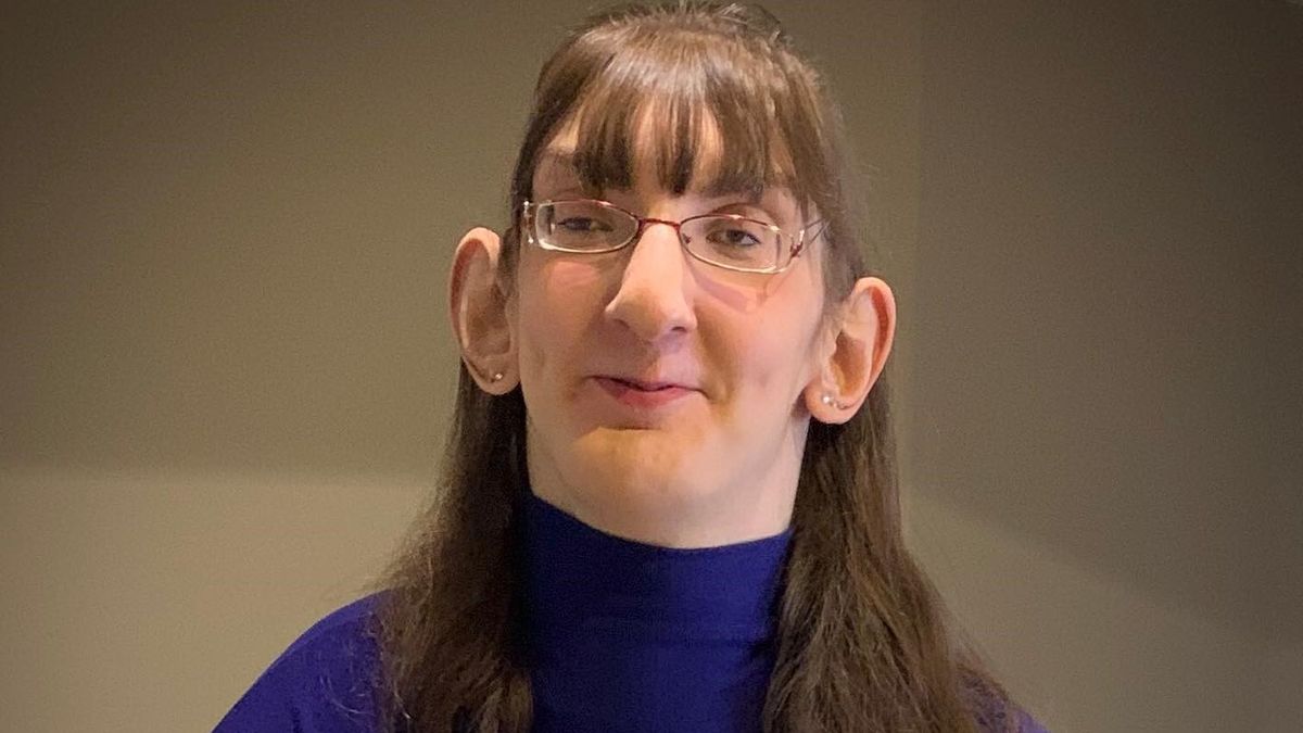 26-letnia Turczynka jest najwyższą kobietą na świecie