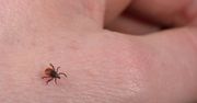 Borelioza - choroba trudna do zdiagnozowania