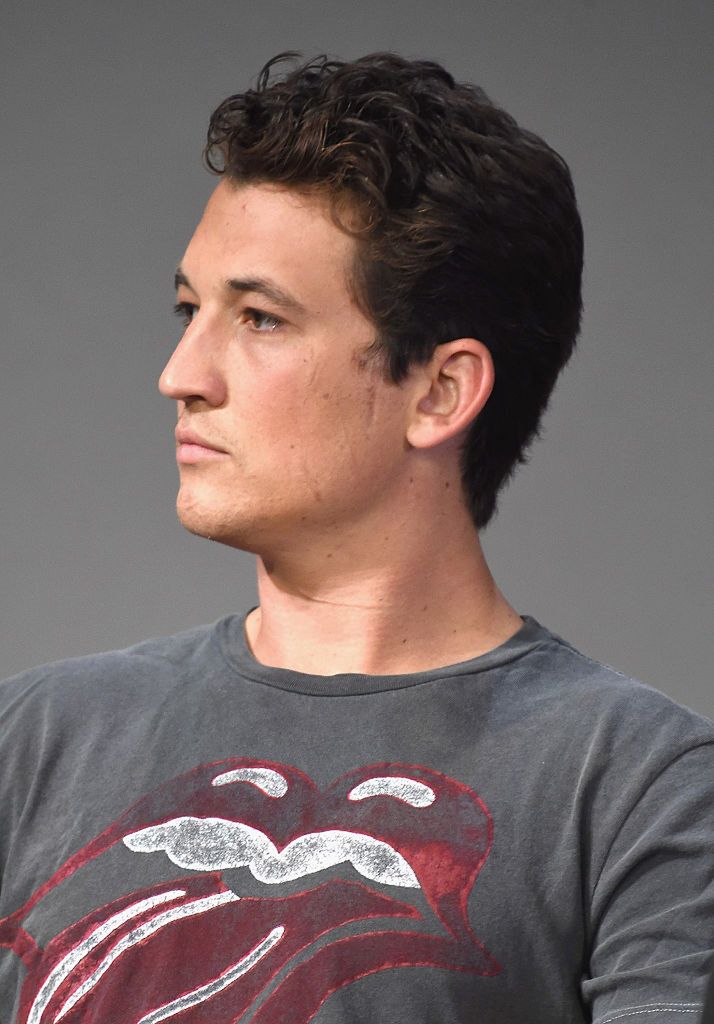 Blizny po wypadku stały się jego znakiem rozpoznawczym