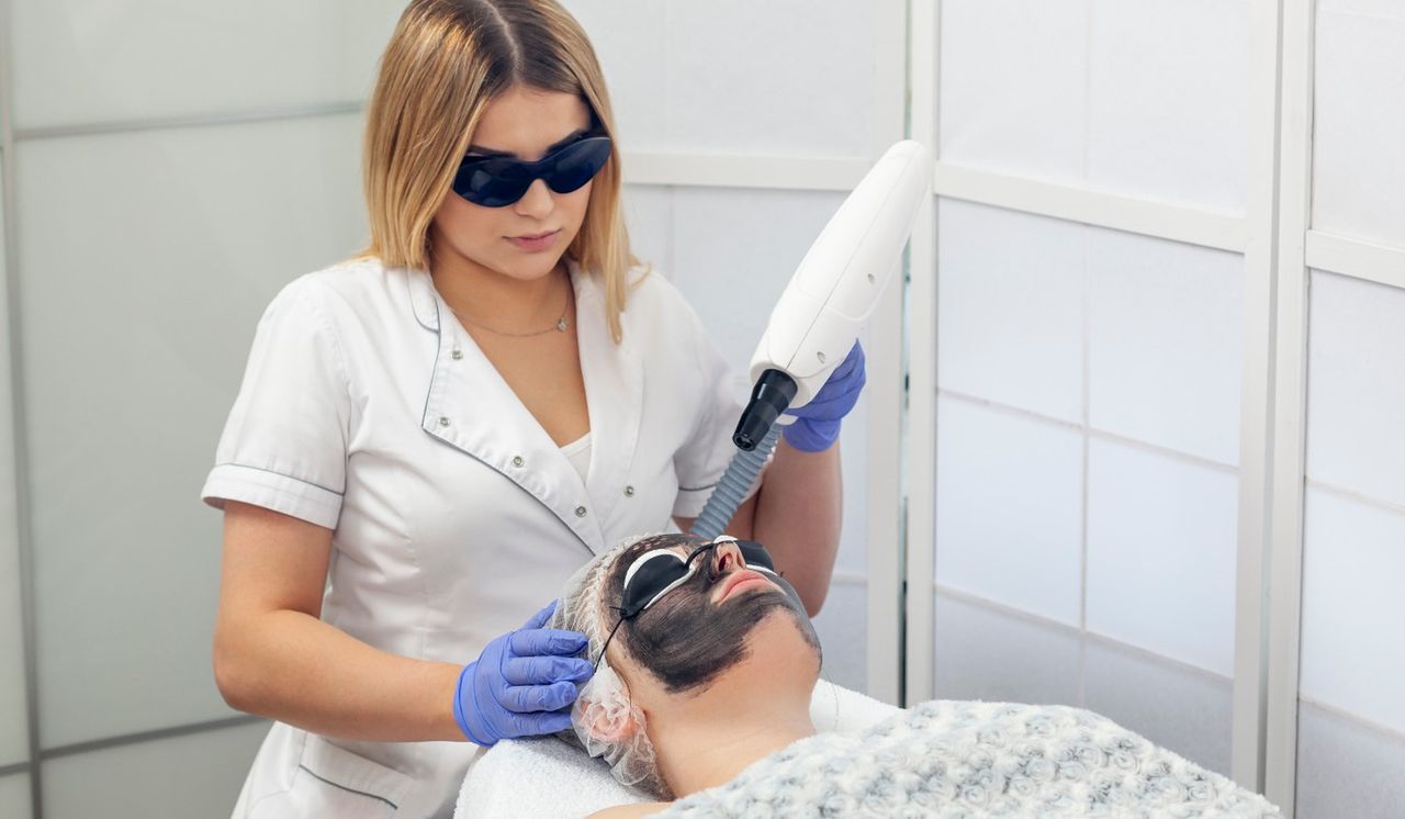 Zabieg black doll (laserowy peeling węglowy) - co to jest, efekty, cena, wskazania i przeciwwskazania, opinie