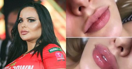 Esmeralda Godlewska KRADNIE ZDJĘCIA zrobionych ust do promocji własnego gabinetu?! "Muszę Was przed nią PRZESTRZEC"