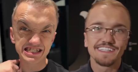 Mini Majk pokazał swoje ZĘBY "PRZED I PO". Fajne wyszły? (ZDJĘCIA)