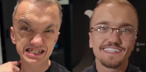 Mini Majk pokazał swoje ZĘBY "PRZED I PO". Fajne wyszły? (ZDJĘCIA)