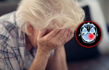 Szansa w leczeniu glejaka? Naukowcy użyli wirusa opryszczki