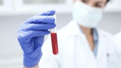 Niedługo skończy 100 lat. Jest zakażony wirusem HIV