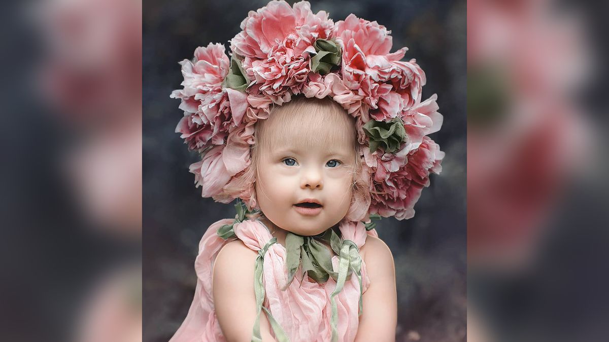 Adoptowała dziewczynkę z zespołem Downa. Robi jej prześliczne zdjęcia pełne miłości 1