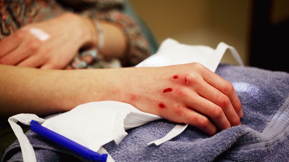 Nie możemy mylić przemocy domowej z "awanturą"