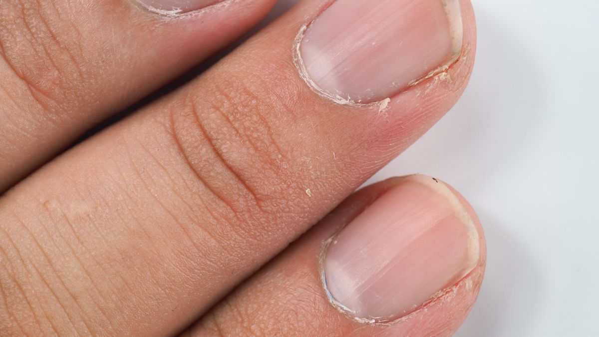 Cropped Image Of Human Hand On White BackgroundTanawat Kraikun / EyeEmfinger nail, cropped, horizontal image