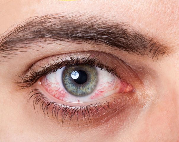 Dark mode pozytywnie wpływa na suchość oka