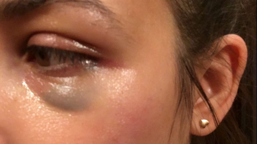 Kobieta została pobita w parku Cytadela w Poznaniu. 