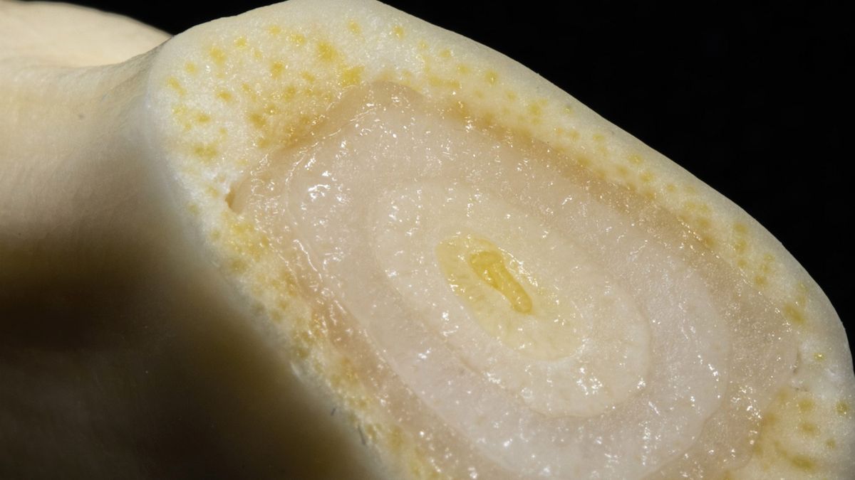 Jedz codziennie, a niealkoholowe słuszczenie wątroby nie będzie ci grozić