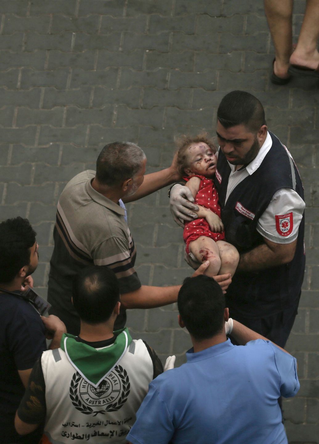 Hundreds killed in the Gaza Strip 