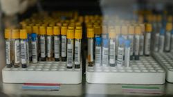 Nie miała wirusa, ale wynik wyszedł dodatni. "Mogłam nawet stracić ciążę"